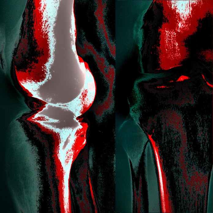 electrically charged